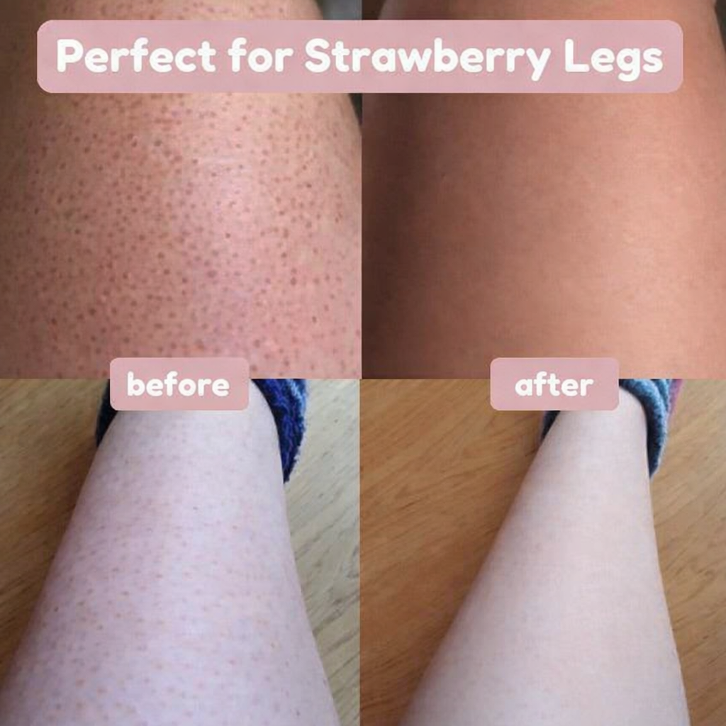 Alcuras™ 2-in-1 women's razor for smooth and well-groomed skin